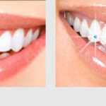 DENTAL JEWELLERY