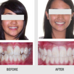 ORTHODONTIC TREATMENT