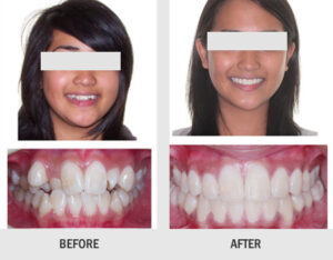 ORTHODONTIC TREATMENT